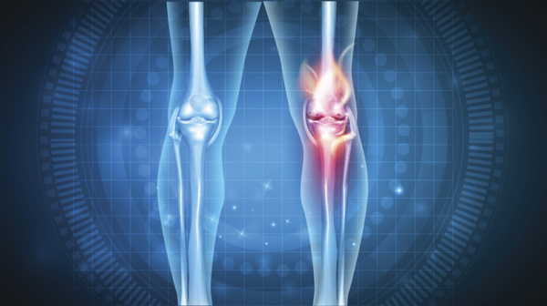 If you have knee pain, telehealth may help